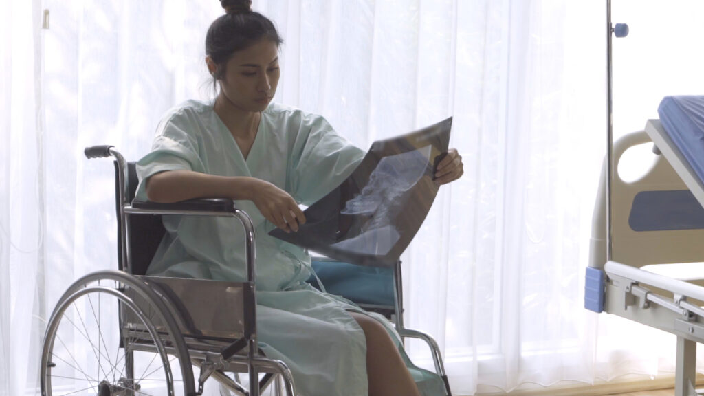 Woman sitting in a wheelchair looking sadly at X-Rays. If you’ve been severely injured due to the negligence of others, a severe injury lawyer can help you. 