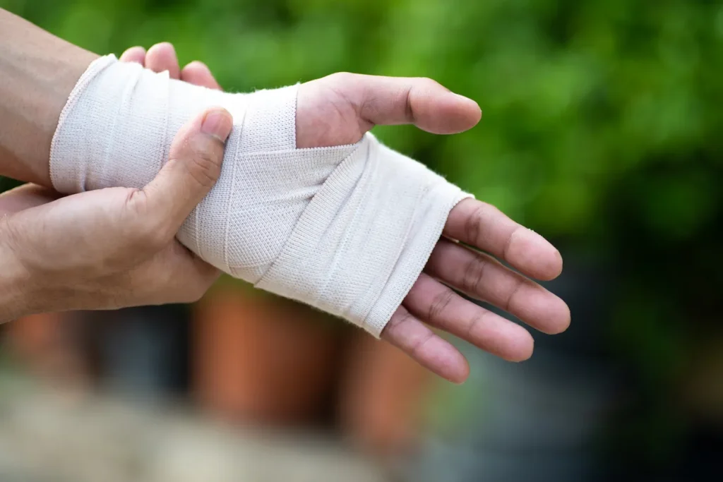 A cast on someone's wrist after they suffered a personal injury and needed to hire a personal injury lawyer.