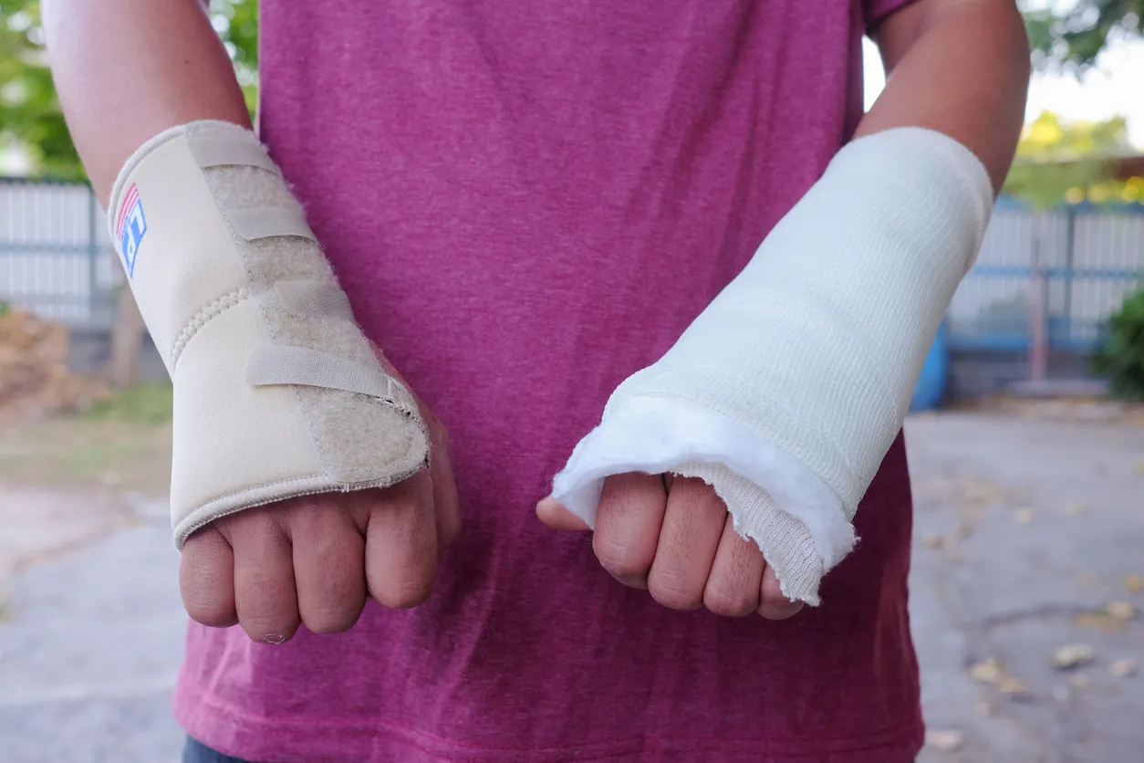 Person with a cast on each wrist after a personal injury where they needed to hire a personal injury lawyer.