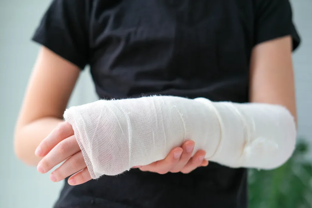 Person in an arm cast after a personal injury. They will need a personal injury lawyer.