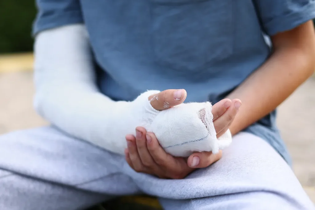 Person in arm cast after a personal injury. They will need to contact a personal injury lawyer.